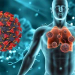 Një valë e re e imunoterapisë po ELIMINON kancerin!/71-vjeçarja i thotë ‘lamtumirë’…