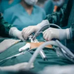 Arrestohet në Beograd shtetasi nga Maqedonia që shtirej si kirurg, mashtrime mbi 100 mijë euro