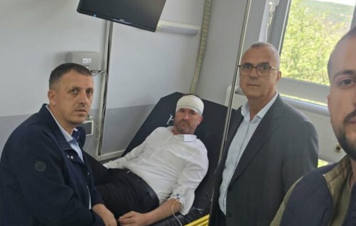 Dy të arrestuar për sulmin ndaj zv ministrit në Skenderaj