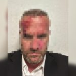 Sulmi ndaj Hysni Mehanit, Spitali i Përgjithshëm në Mitrovicë jep detaje