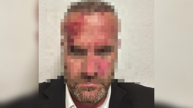 Sulmi ndaj Hysni Mehanit, Spitali i Përgjithshëm në Mitrovicë jep detaje